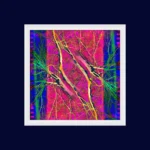 Pop Artbre Fuschia - Impression d'Alexandra Daoust - VetrinArte