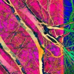 Pop Artbre Fuschia - Impression d'Alexandra Daoust - VetrinArte