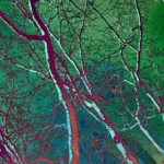 Pop Artbre Green - Impression d'Alexandra Daoust - VetrinArte